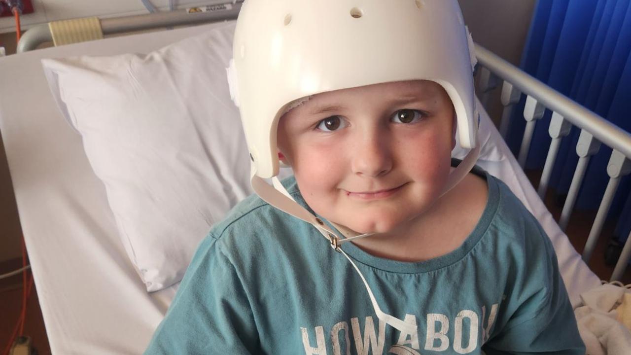 ‘You don’t have a choice’: Boy’s skull begins to dissolve