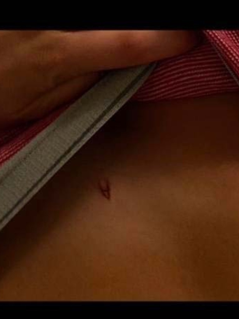 Paige Lorenze shared this photo of Hammer’s initial carved into her skin. Picture: Splash News