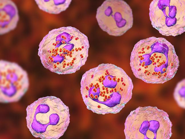 Meningococcal meningitis, cerebrospinal fluid smear containing neutrophils with and without bacteria Neisseria meningitidis, 3D illustration