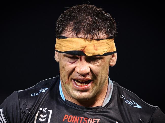 SYDNEY, AUSTRALIA - MARCH 23: 7 Dale Finucane of the Sharks walks off after receiving a cut during the round three NRL match between Wests Tigers and Cronulla Sharks at Leichhardt Oval, on March 23, 2024, in Sydney, Australia. (Photo by Jeremy Ng/Getty Images)