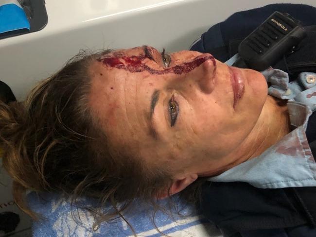 The officer was left with a 2.5cm open wound to her forehead. Picture: NSW Police