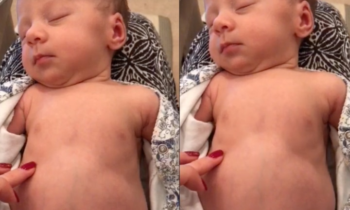 Baby belly breathing while hot sale sleeping