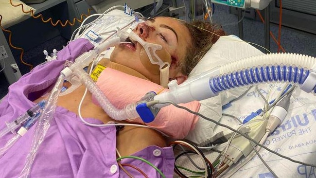 Alexa Leary in hospital after her life-changing horror cycling accident.