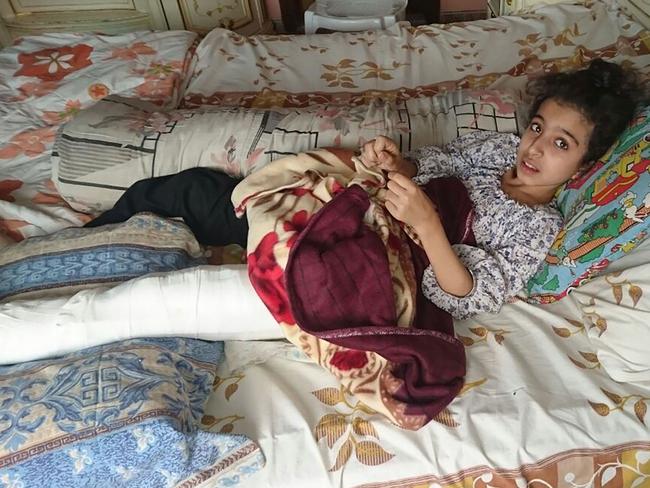 One of the many children injured in Syria. Ghina Ahmad Wadi rests at her home in the Syrian city of Madaya after being shot in the leg while buying medicine for her mother. Picture: AFP/Amnesty International