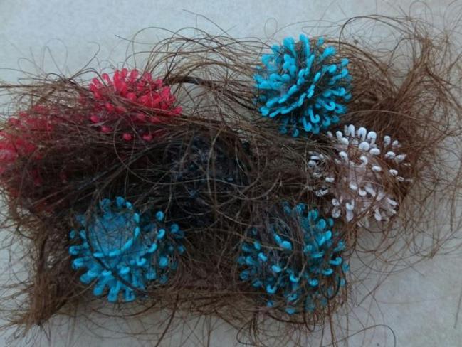 Popular Toy Bunchems Causing Hair-Raising Experiences for Parents, Kids -  ABC News