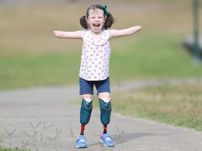 Mia Wilkinson, 6, lost her hands and feet to sepsis following a bout of the flu in 2017. PicTURE: Peter Wallis