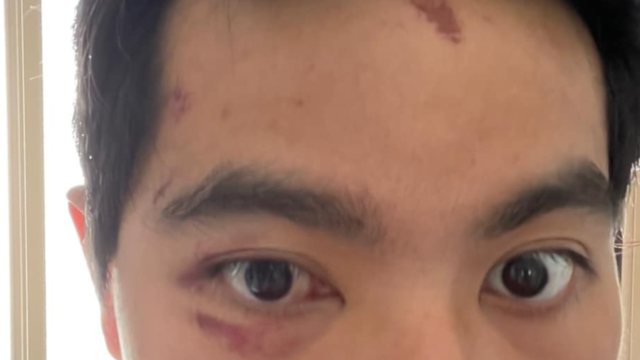 UQ student Andrew Shih was attacked in Dawson Phipps Park in Gatton on January 20.