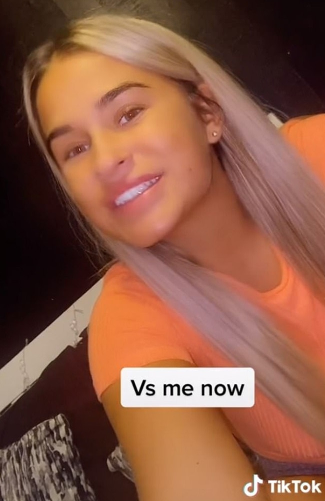 Morgan said the swelling eventually subsided. Picture: TikTok/mp1997x