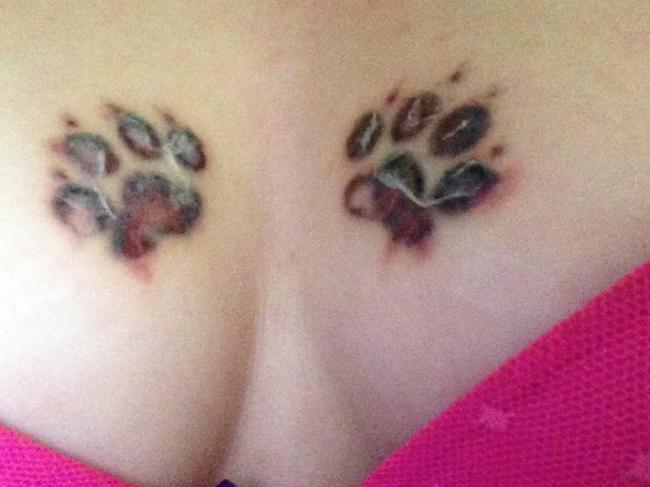 When tattoo removals go horribly wrong