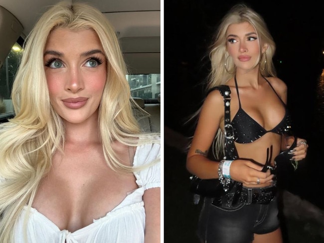 Sami Sheen pulls a Kylie Jenner and shares exact details of breast augmentation