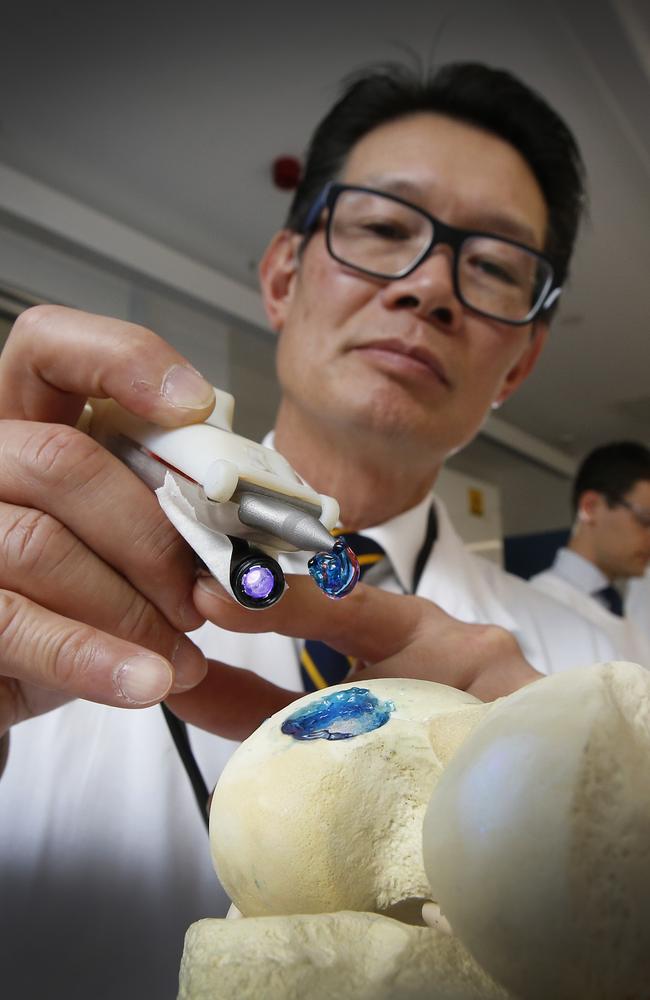 St Vincent’s Hospital orthopedic surgeon Prof Peter Choong practises using a 3D pen on a model of a knee joint with medical students Domagoj Vodanovic and Benjamin Murphy. Picture: David Caird