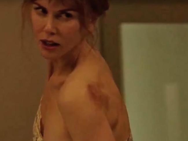 Nicole Kidman’s character in Big Little Lies tried to hide the bruises her husband inflicted regularly. Picture: Foxtel