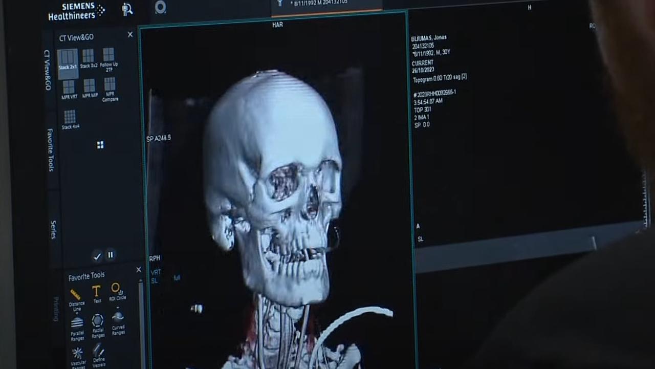 Scans produced by the Royal Hobart Hospital's new SOMATOM X.ceed CT scanner. Picture: Supplied