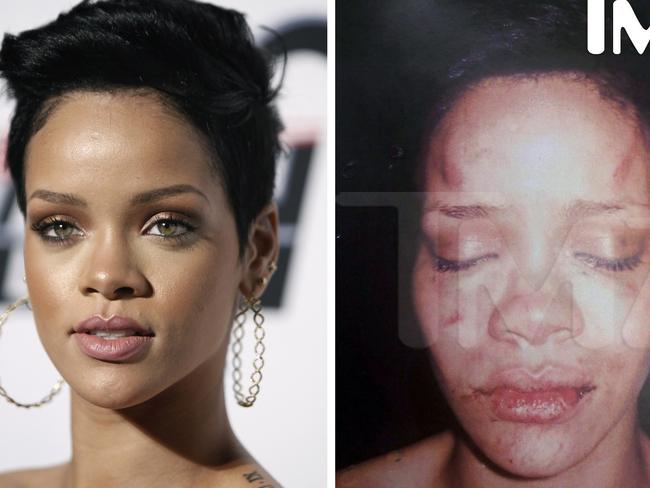 af officiel indtil nu Chris Brown: singer reveals truth about night he assaulted Rihanna |  news.com.au — Australia's leading news site