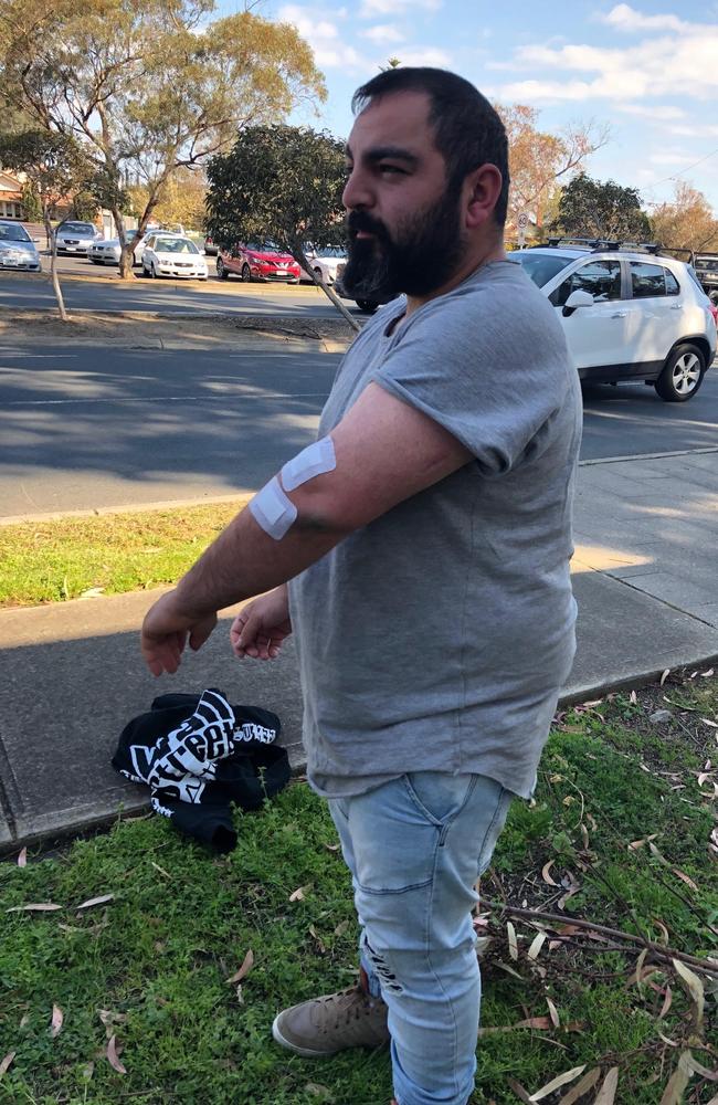 Victim Necip Tali, 32, said he feared for his life as the “idiot” driver allegedly sped about 150m with him on the bonnet.