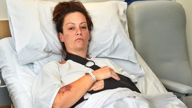 Michelle Nash recovering in hospital after she was hit by Su’a. Picture: Tony Gough