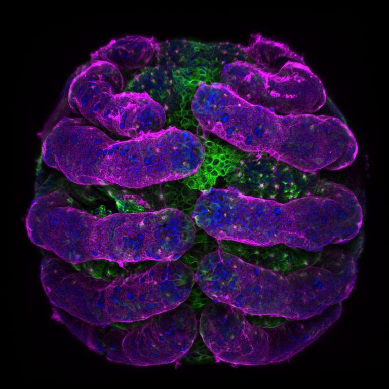 5th Place Spider embryo Picture: Dr. Tessa Montague