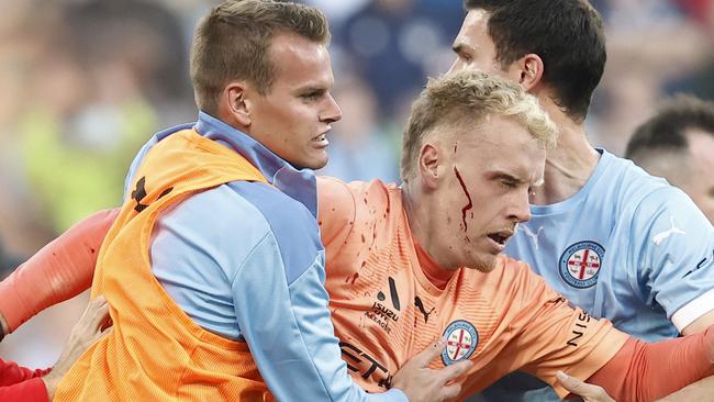 Melbourne derby disaster hard to forget