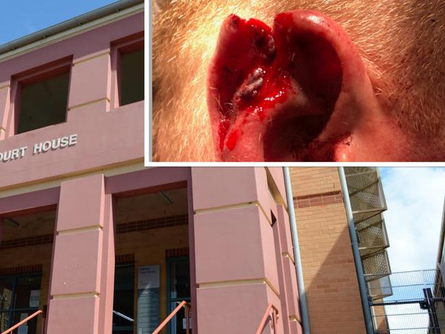 The trial off an alleged pub assault which resulted in a partially severed ear of a off-duty cop has hit day three.