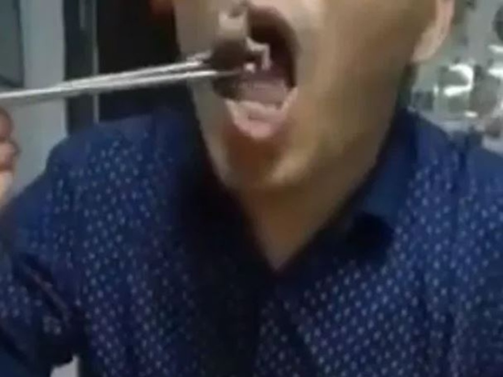 Coronavirus: Chinese man eats baby mice alive | video | The Chronicle