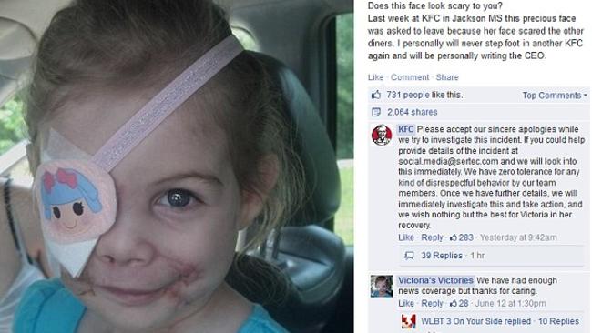 BREKKIE WRAP: Victoria Wilcher, 3, told to leave a KFC because her face was  'scaring other diners