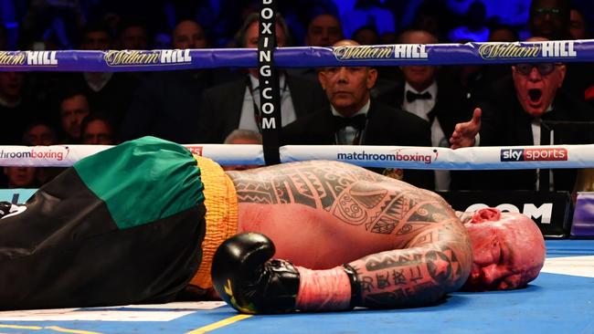 Lucas Browne lays on the canvas as he is knocked out by Dillian Whyte.