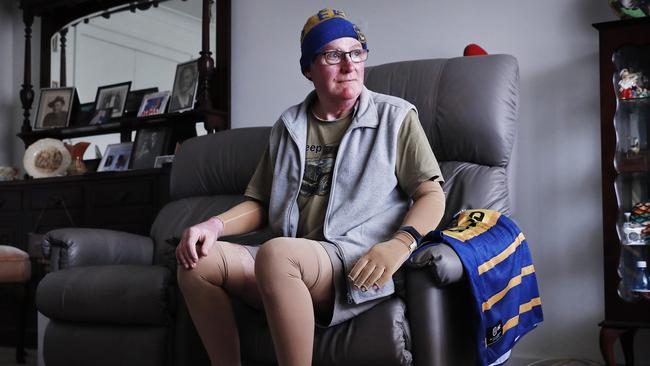 Parramatta fan and volcano eruption survivor John Cozad pictured at home today in Swansea. Picture: Sam Ruttyn