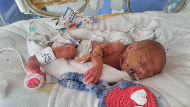 Warwick Atticus Nation weighed 807g when he was born 14 weeks premature.