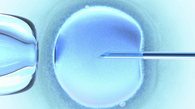 The two free IVF rounds is one recommendation under a $42 million promise to make the procedure more affordable.