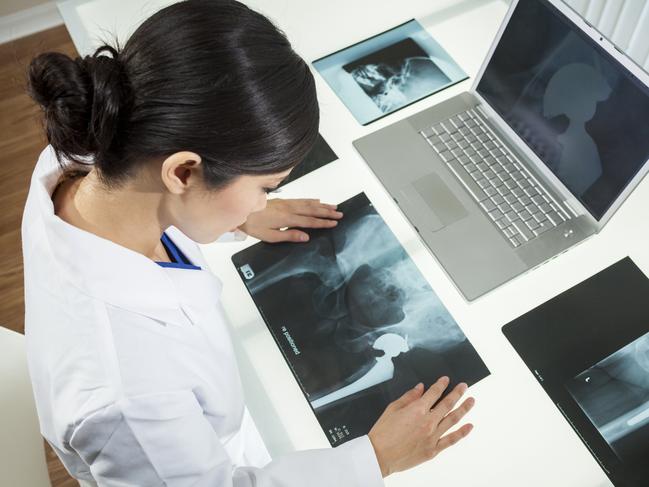 An Asian Chinese female medical doctor looking at x-rays of hip replacement and using laptop in a hospital