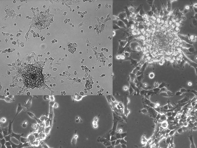 Images of Josie’s ‘jump 4 cells’ of the tumour that killed her are being grown in Dr Matt Dun’s lab.