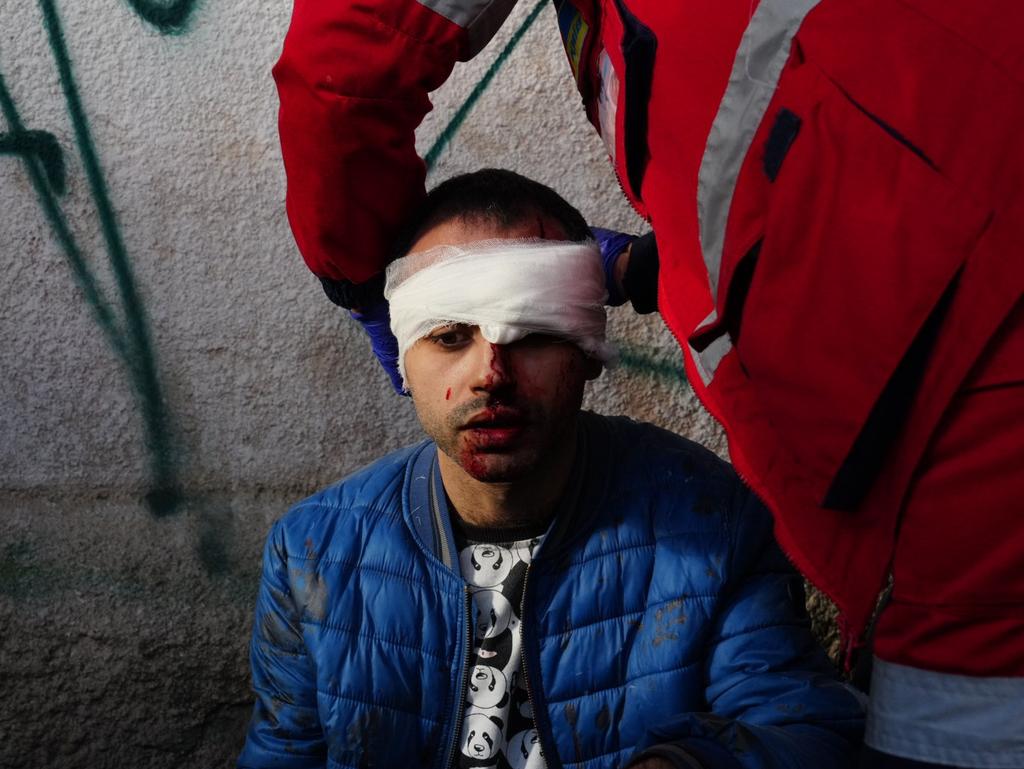 An injured civilian is helped by a medic at the scene after several explosions rocked the Shevchenkivskyi district of the Ukrainian capital, Kyiv. Picture: Anadolu Agency via Getty Images