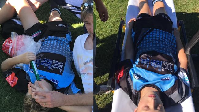 Adam Wallace suffered a horror injury playing junior rugby league where he dislocated his hip. Pictures: Supplied