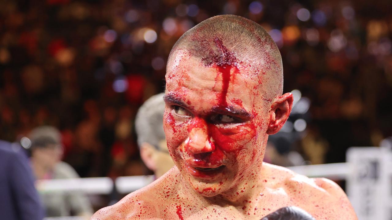 LAS VEGAS, NEVADA - MARCH 30: WBO junior middleweight champion Tim Tszyu (L) walks to his corner after a 12-round fight against Sebastian Fundora at T-Mobile Arena on March 30, 2024 in Las Vegas, Nevada. Fundora won Tszyu's title and a vacant WBC title by split decision. (Photo by Steve Marcus/Getty Images)