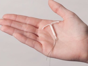 The hormonal IUD