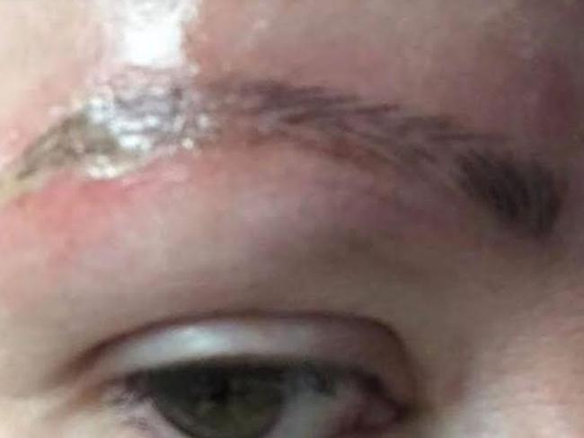 Amanda Coats’ eyebrow shortly after it was tattooed.