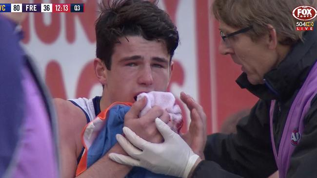 Fremantle Dockers player Andrew Brayshaw after the punch which broke his jaw.