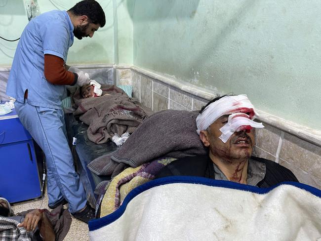 An injured child and two men receive treatment at the Bab al-Hawa hospital, in the rebel-held northern countryside of Syria's Idlib province on the border with Turkey. Picture: AFP