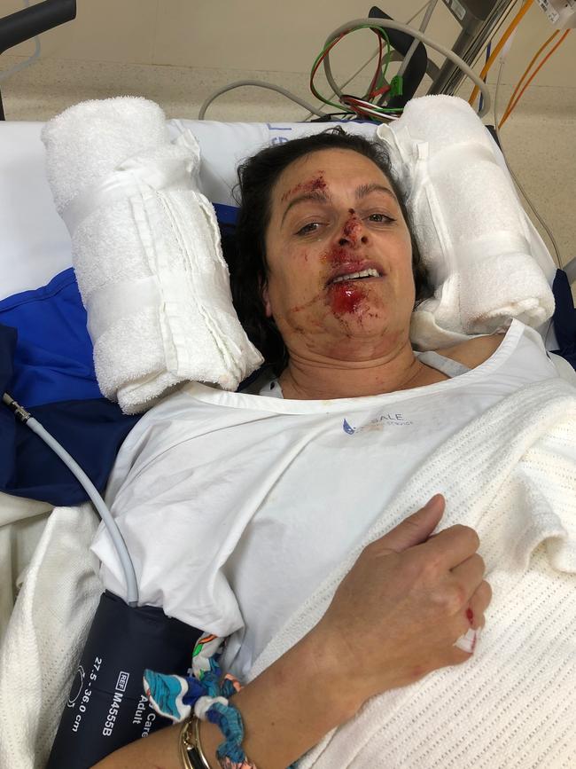 Joanna Mactier in hospital.