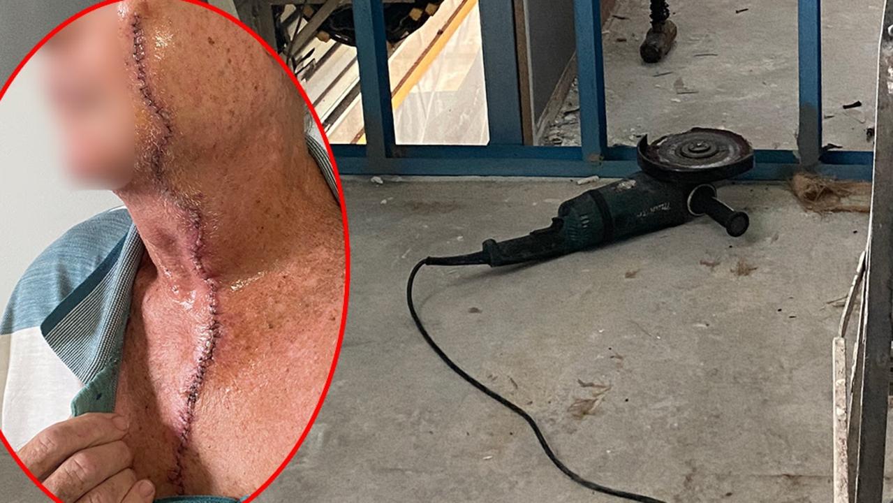 NT worker lacerates face and throat with power tool