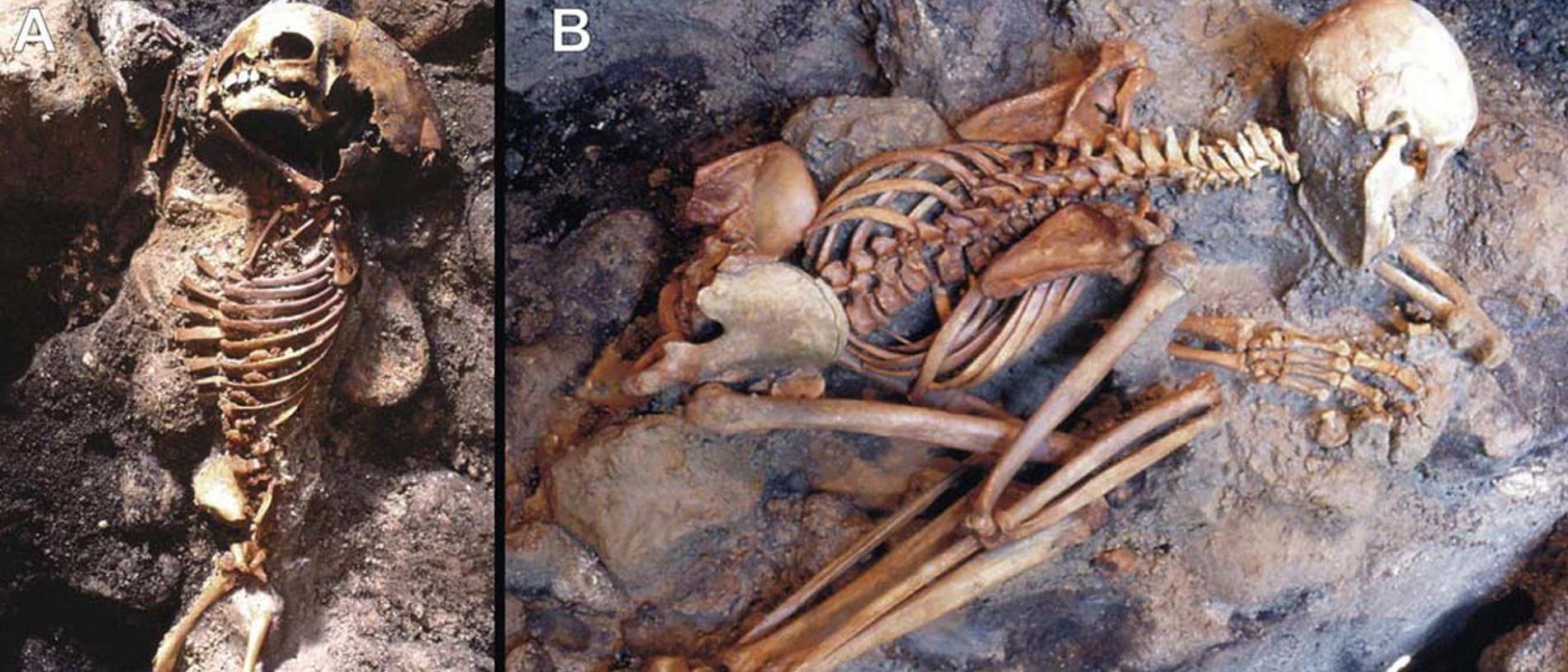 Skeleton of a child in a ‘pugilistic attitude’ which is typical of a body exposed to extremely high temperatures. A skeleton of a young adult male (B) shows a heat-induced stance. Picture: PLOS One