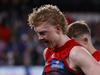 Robbo: Dees shopped Oliver, but so what? It’s a business after all