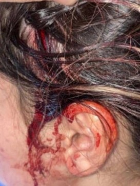 The 17-year-old suffered head injuries. Picture: 2GB.