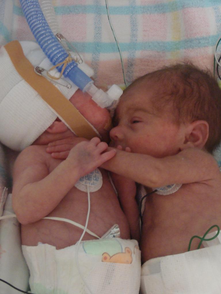 Madison and Sarah Pepper as newborns.