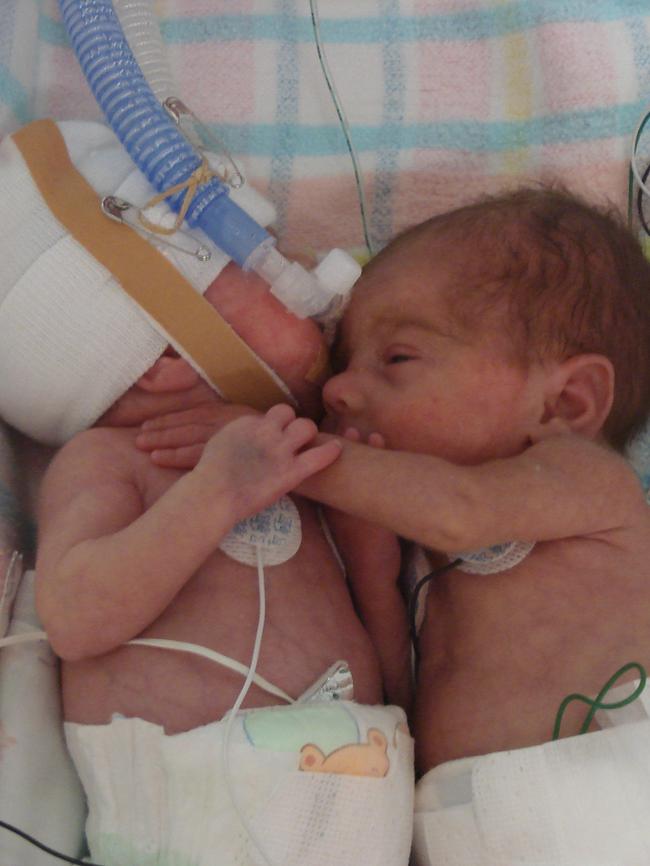 Madison and Sarah Pepper as newborns.