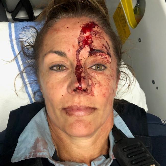 A man was charged after allegedly assaulting a police officer on the Central Coast. Picture: NSW Police