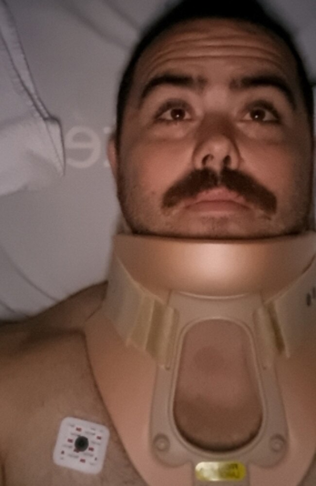 His injuries included a fracture in the C5 vertebrae and a prolapsed and ruptured C5/6 disk, which went inward damaging his spinal cord.