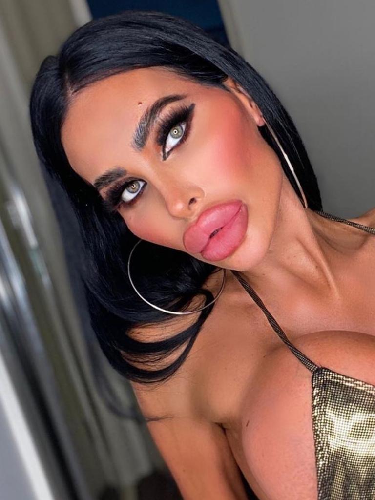 Woman addicted to plastic surgery got 5 boob jobs, Photo