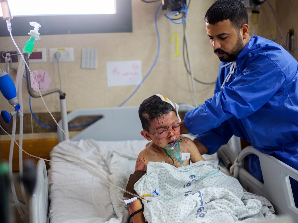 An injured Palestinian child is in an intensive care unit at Nasser Hospital on October 15, 2023 in Khan Yunis, Gaza. Picture: Getty Images