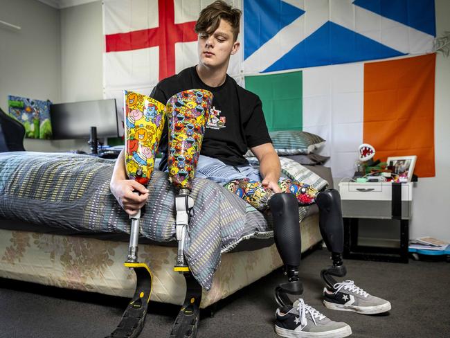 Ted at home with his previous set of prosthetics. Picture: Jake Nowakowski